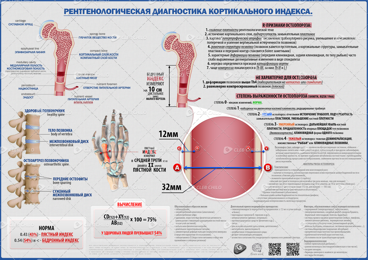 кортикальный индекс